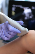 Acute Knee Injury — Ultrasound | Gold Coast